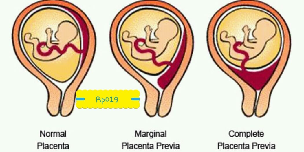 placenta-norienordean